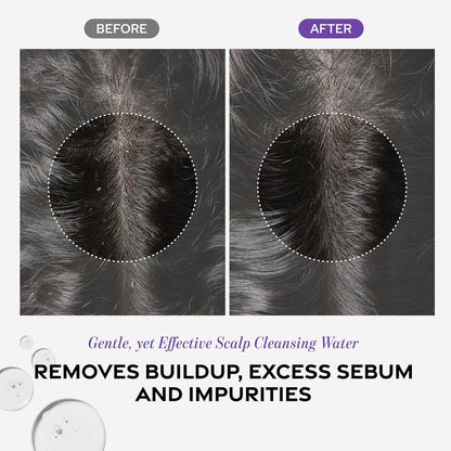 Doctor G. Scalp Revitalizing Solution Scalp Exfoliating Detox Water